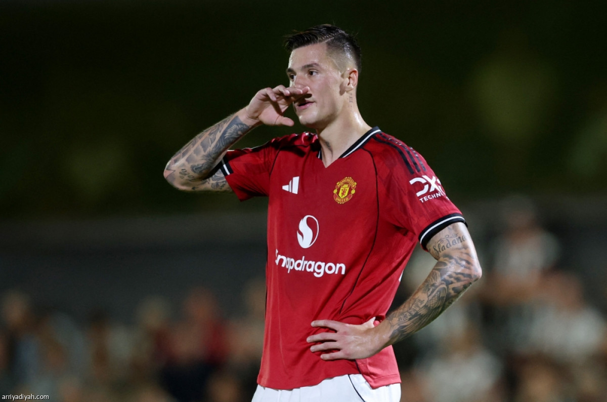 يونايتد.. وداع مبكر