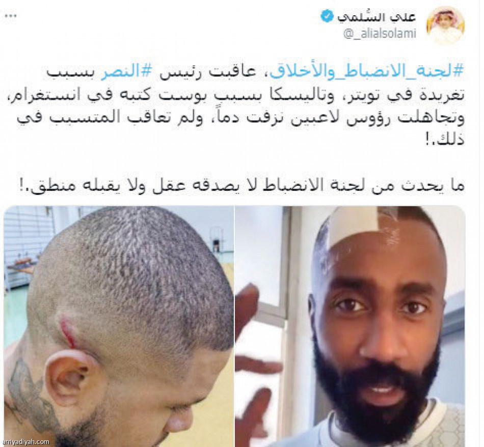 إيقاف العمري.. 
مقارنات وتساؤلات في تويتر